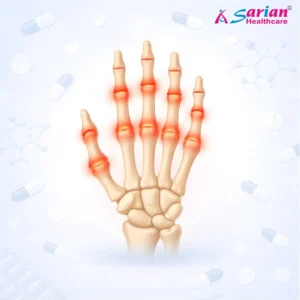 Rheumatology arthritis care medicines
