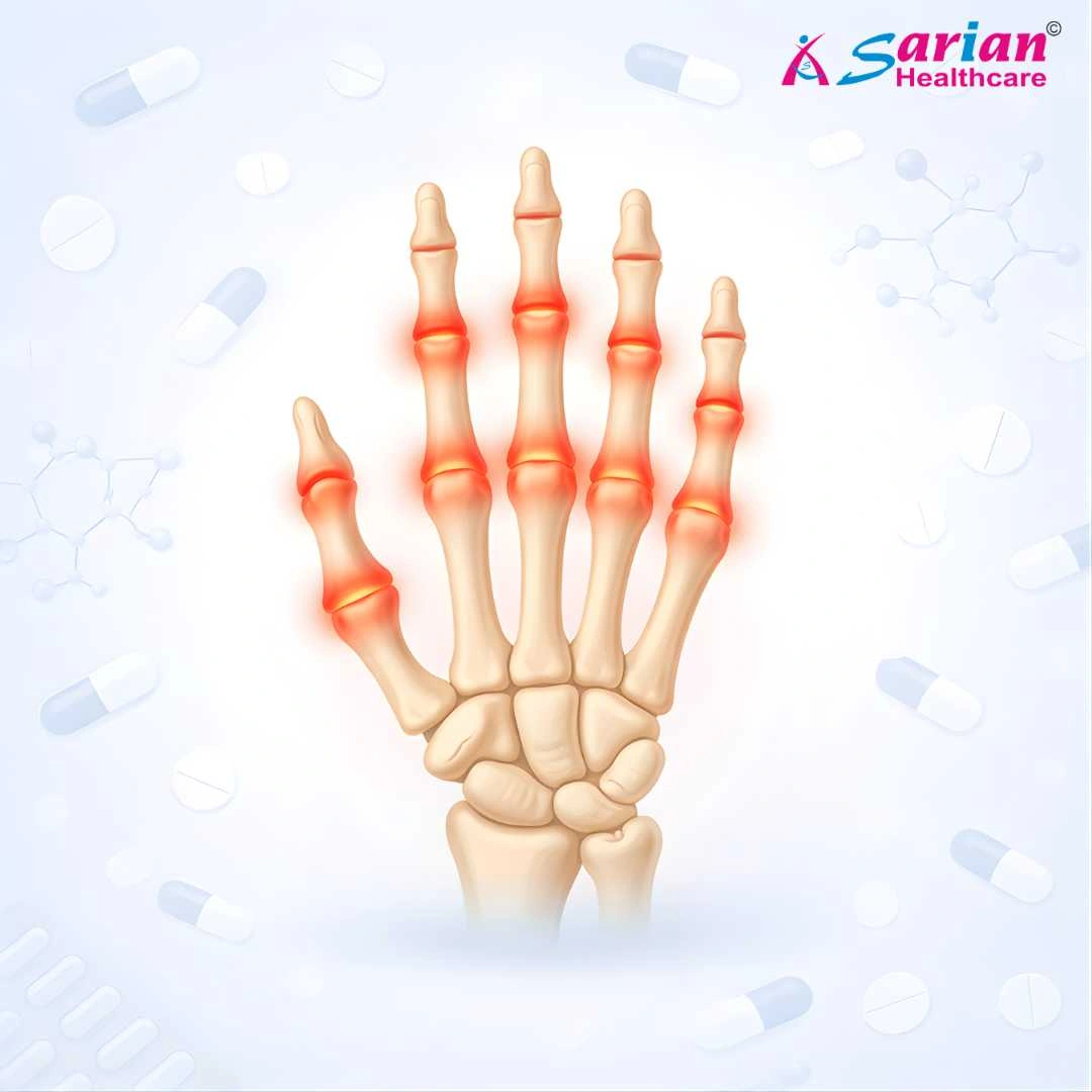 Rheumatology arthritis care medicines
